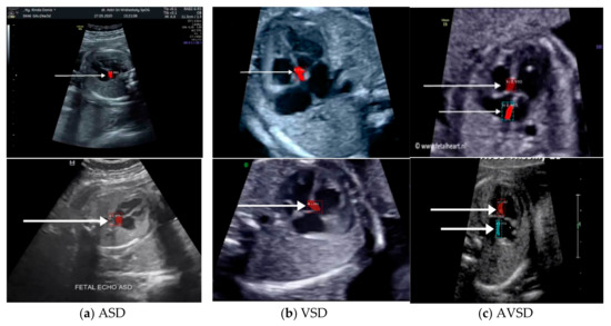 Deep Learning-Based Computer-Aided Fetal Echocardiography