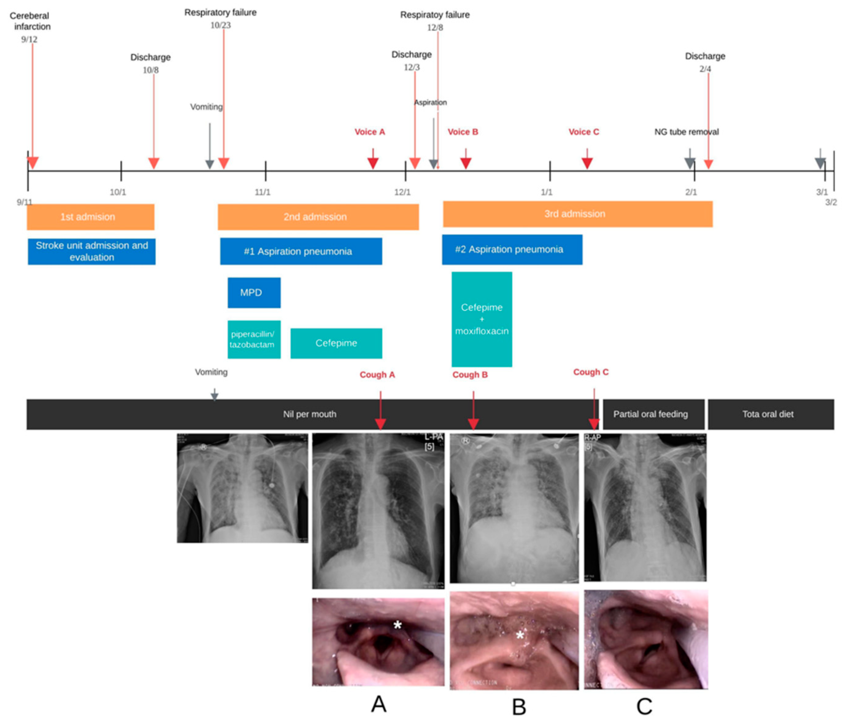 Sensors Free FullText Cough Sounds Recorded via Smart Devices as Useful NonInvasive