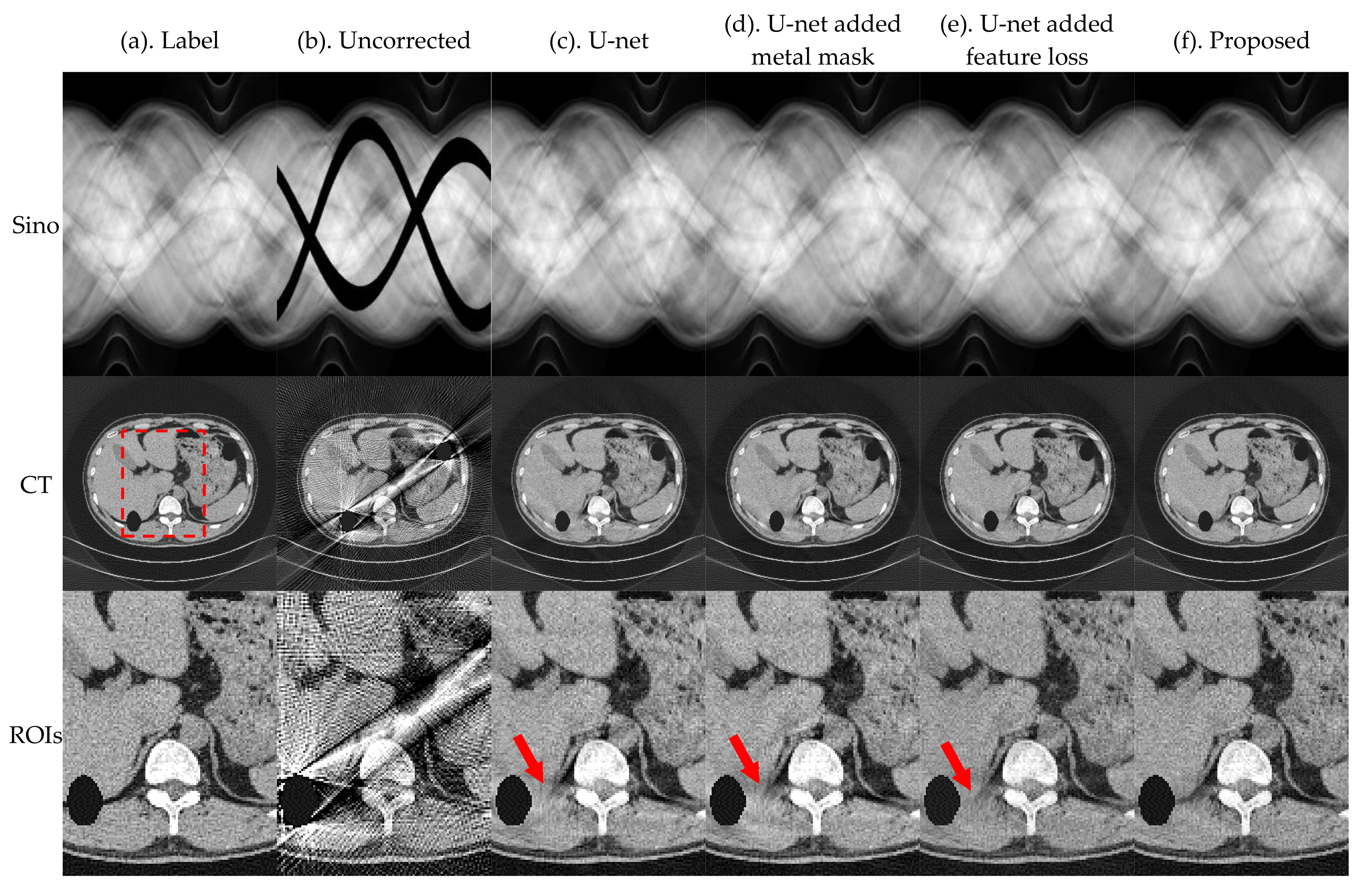 Sensors 21 08164 g011 550