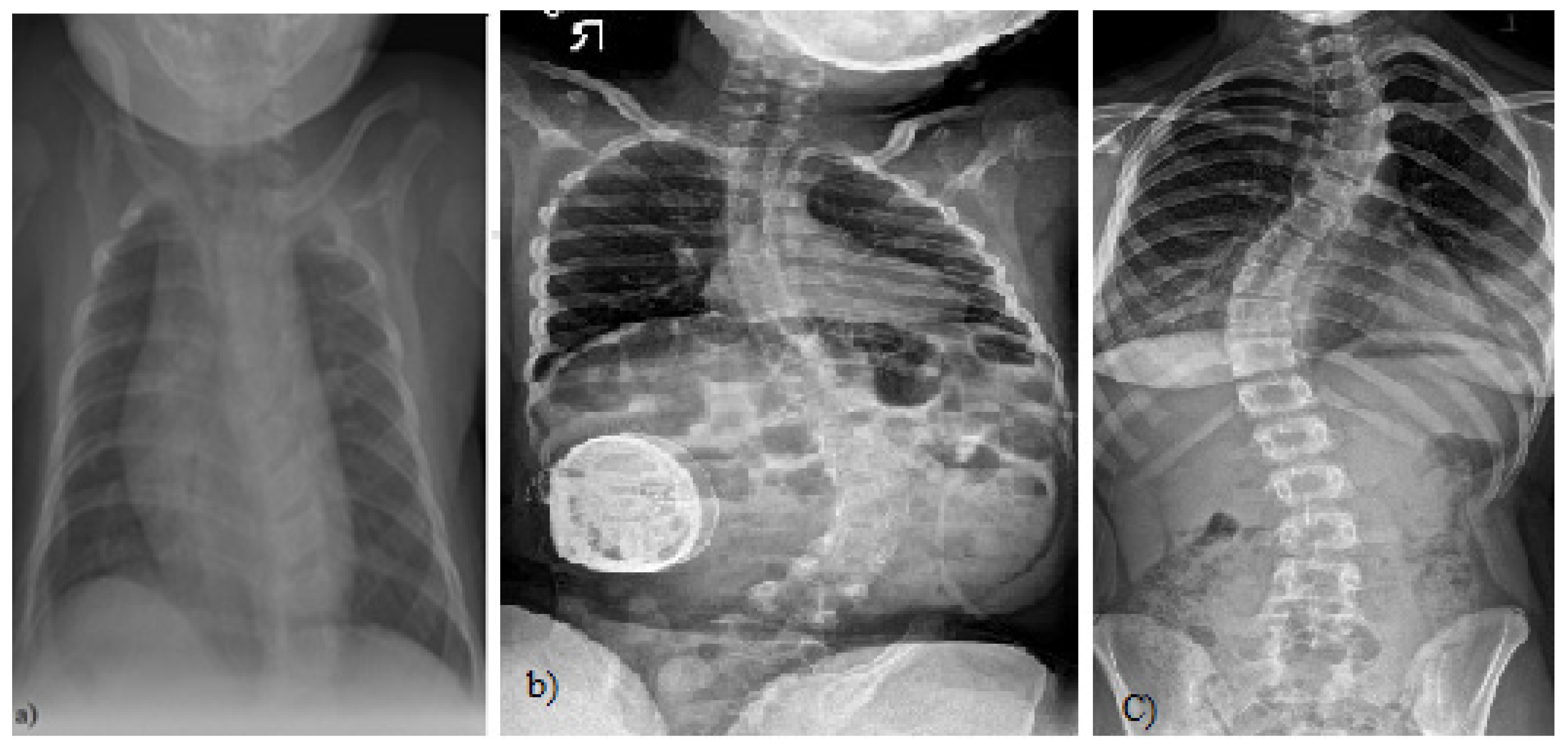 Quantitative Assessment and Measurement of X-ray Detector