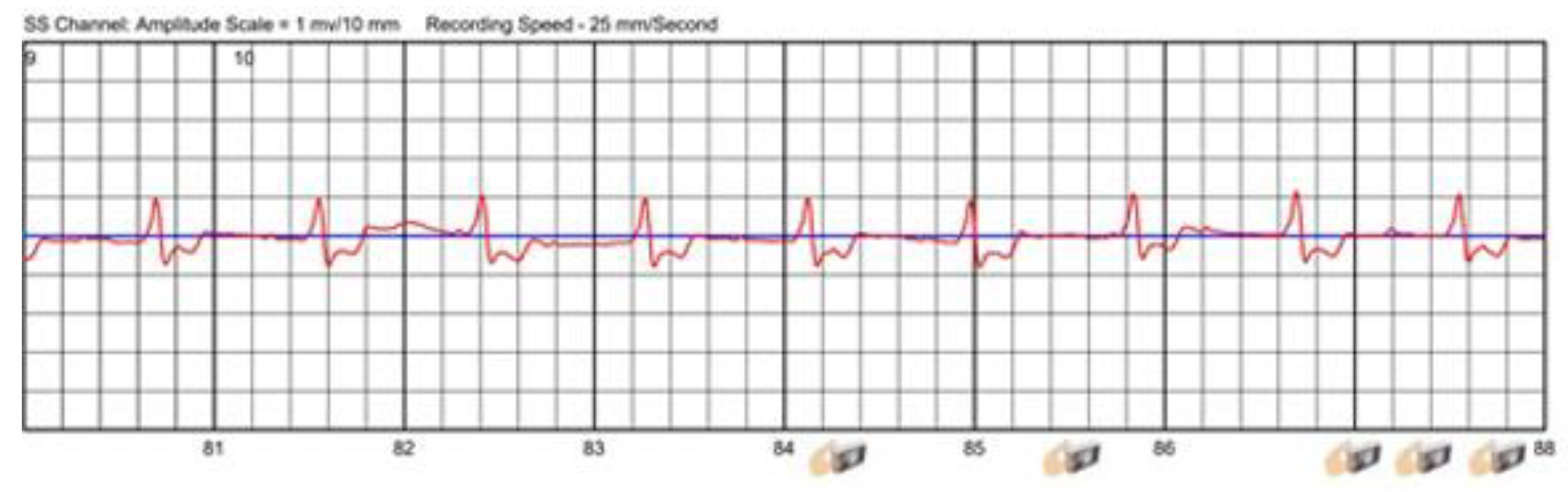 Sensors 22 00022 g007 550