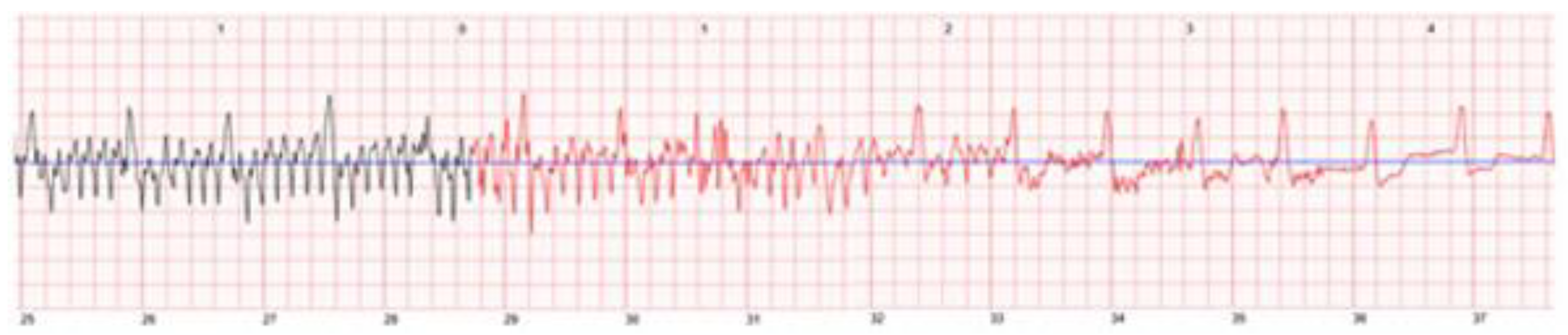 Sensors 22 00022 g009 550