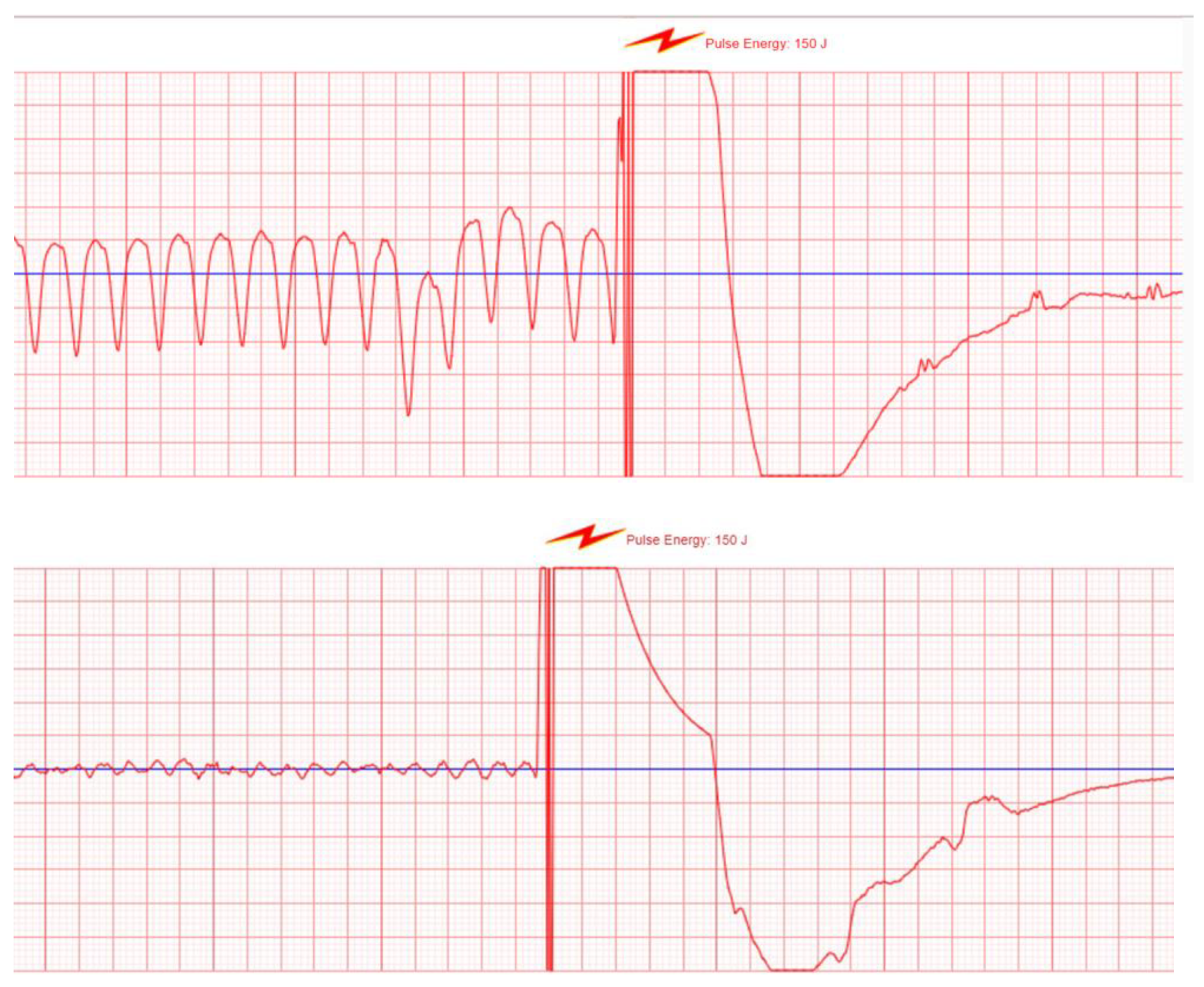 Sensors 22 00022 g010 550