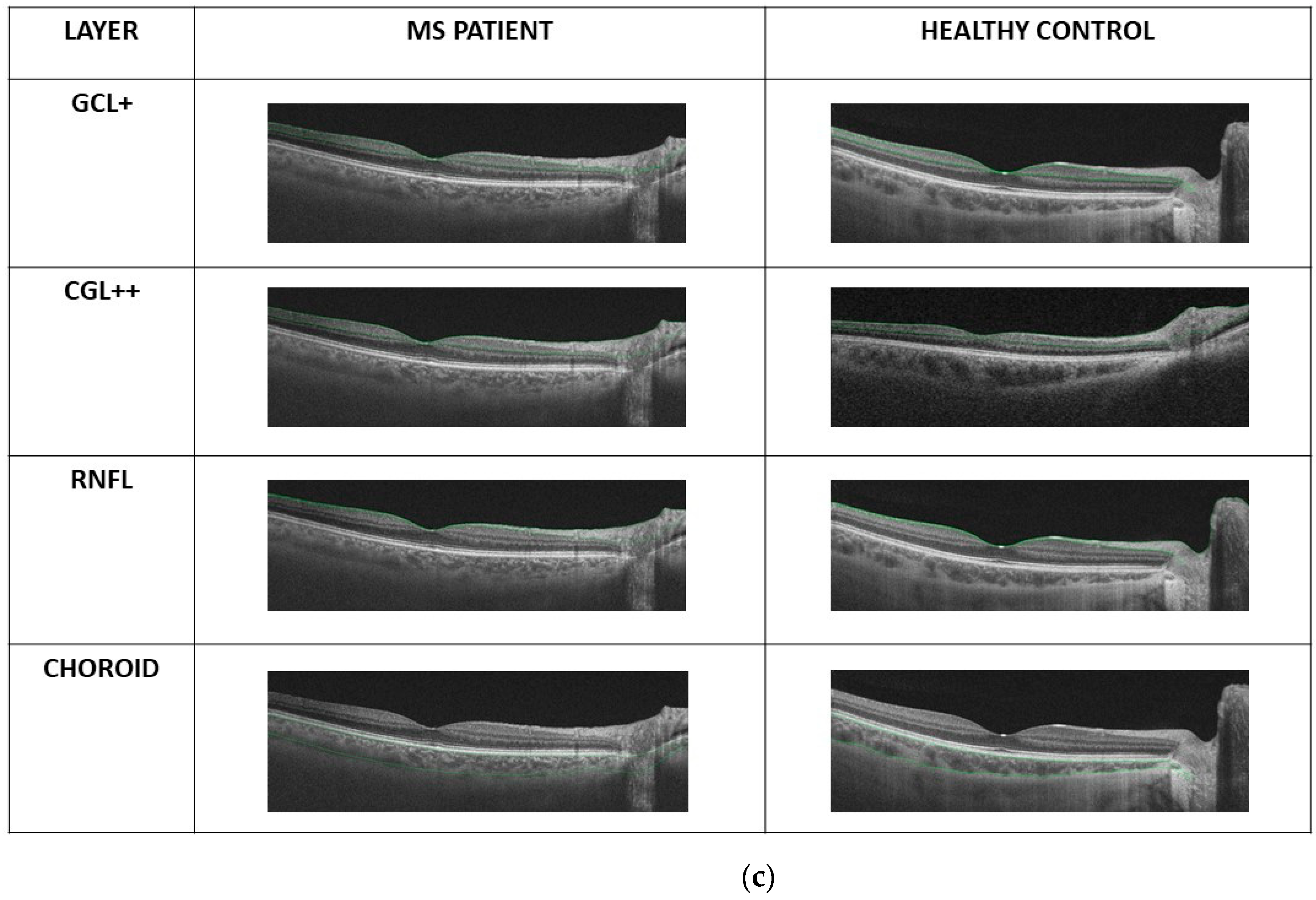 Sensors 22 00167 g001b