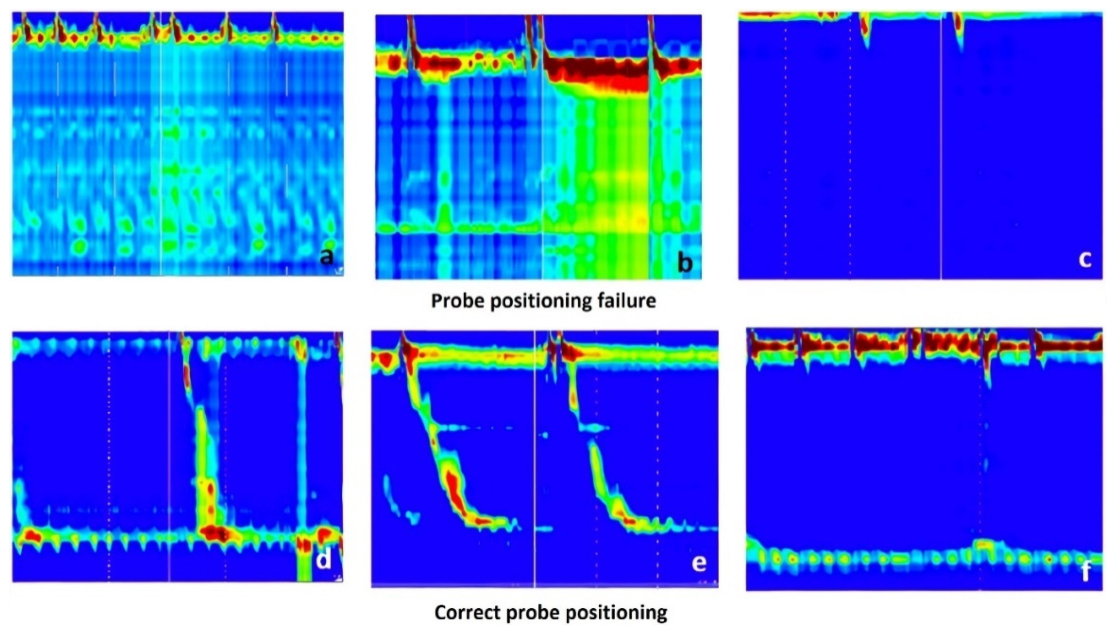 Sensors Free FullText Integrated Relaxation Pressure