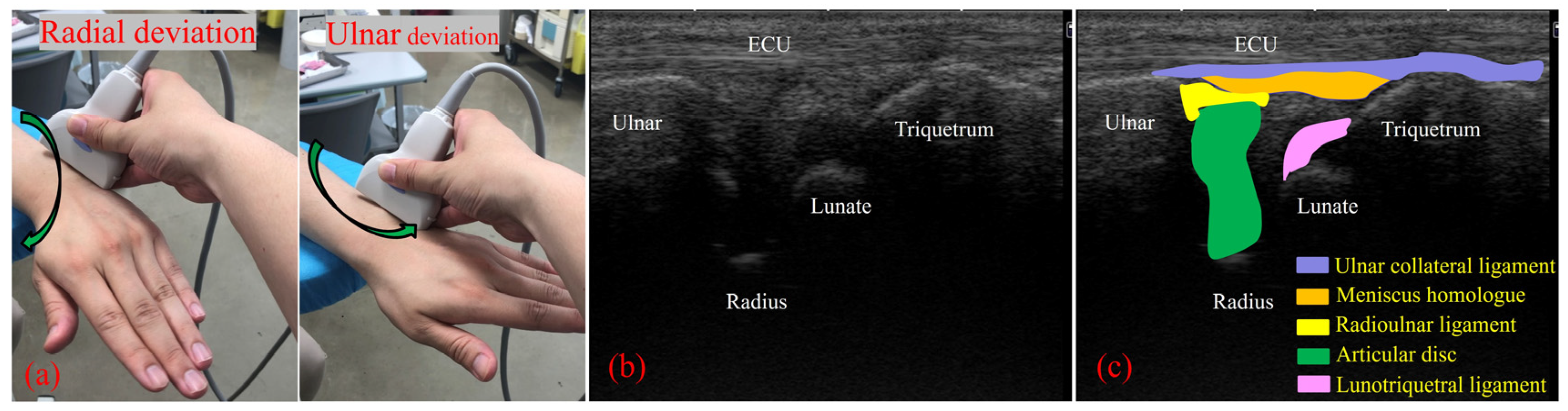Sensors 22 00345 g003 550