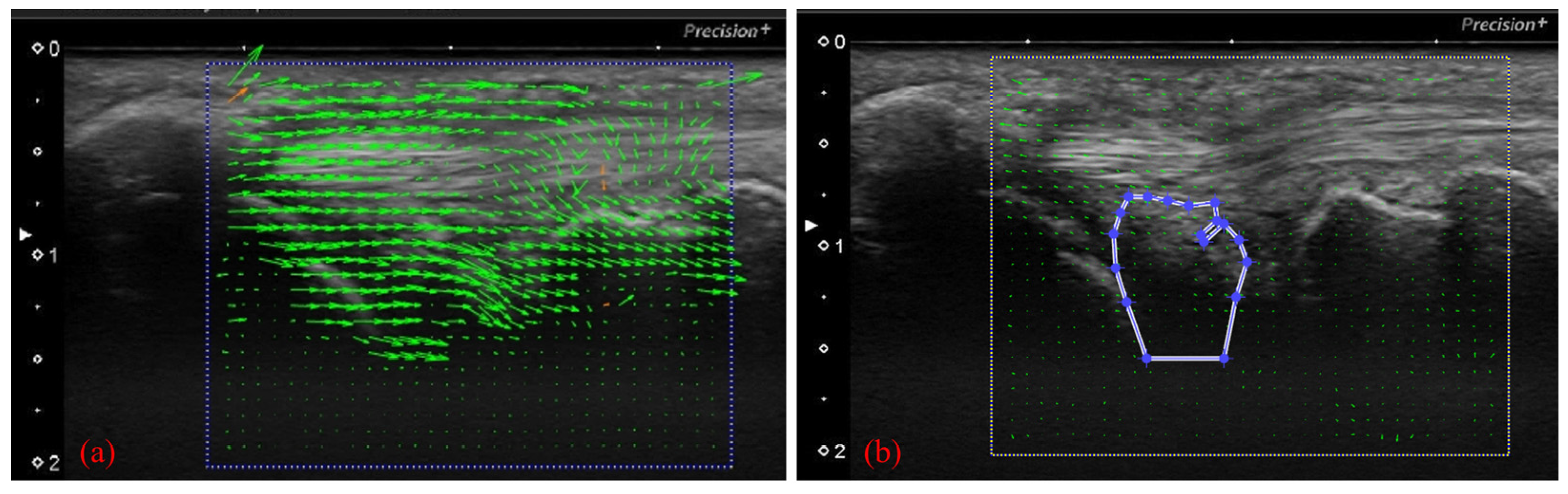 Sensors 22 00345 g005 550