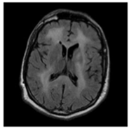 Sensors 22 00372 i001