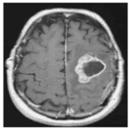 Sensors 22 00372 i002