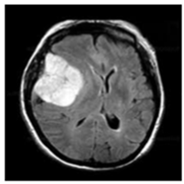 Sensors 22 00372 i003