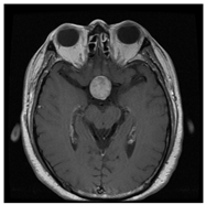 Sensors 22 00372 i004