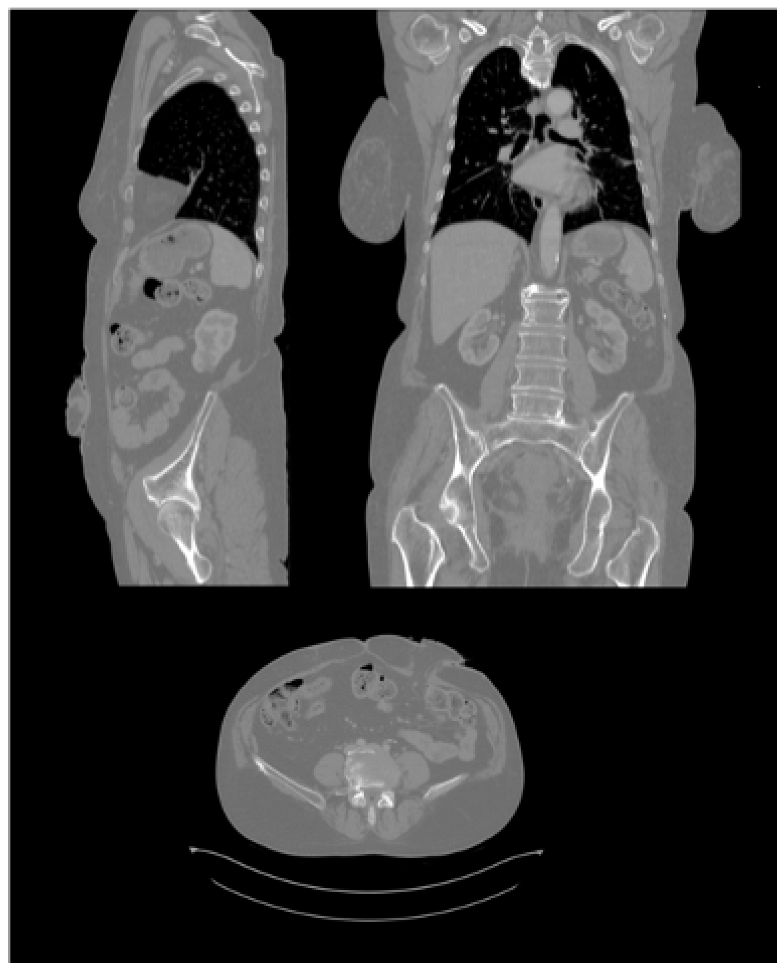 Sensors 22 00560 g007
