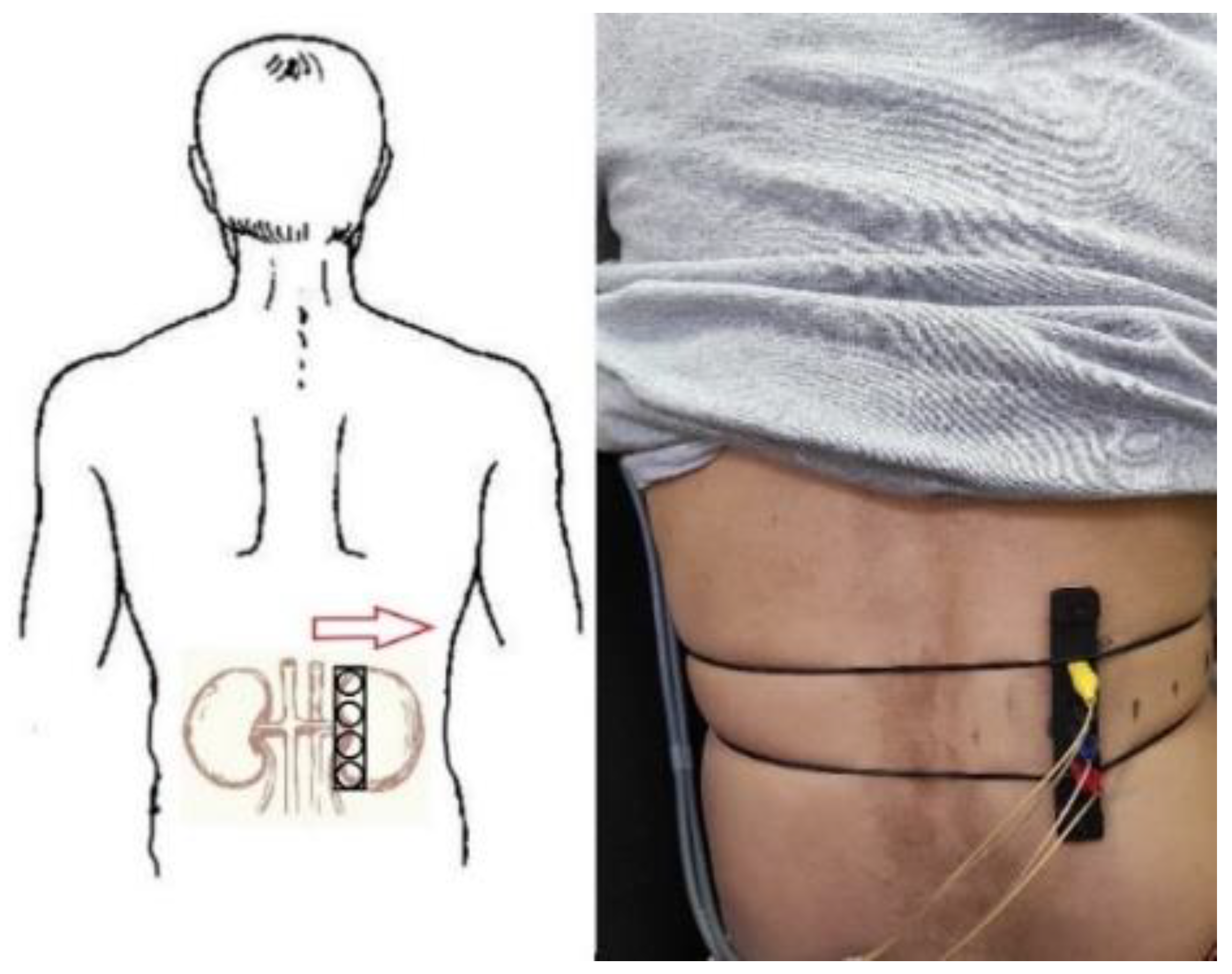 Sensors 22 00606 g006 Sensors 22 00606 g006