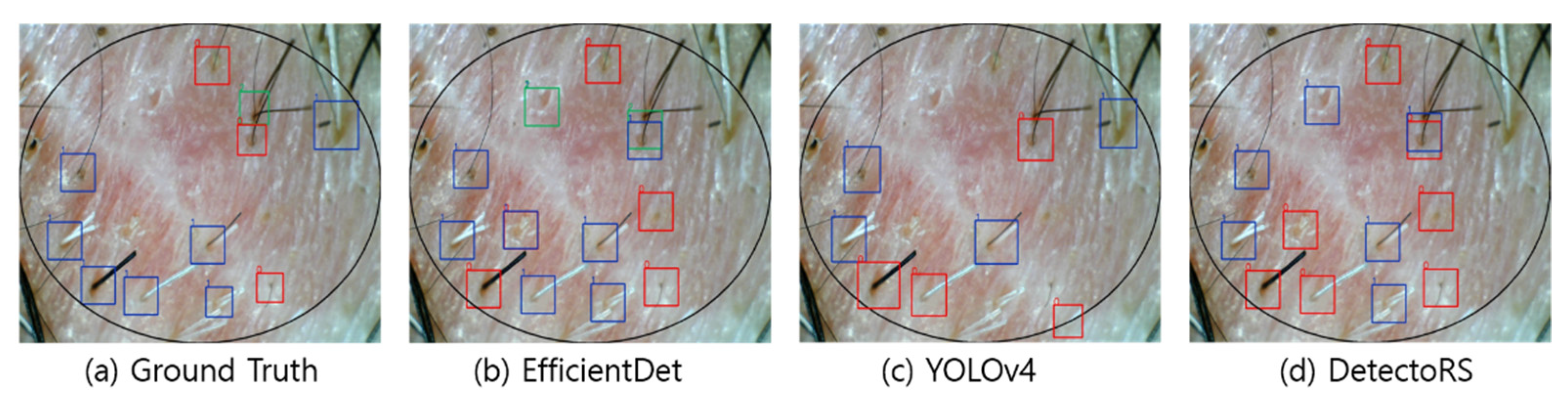 Sensors 22 00650 g006 550