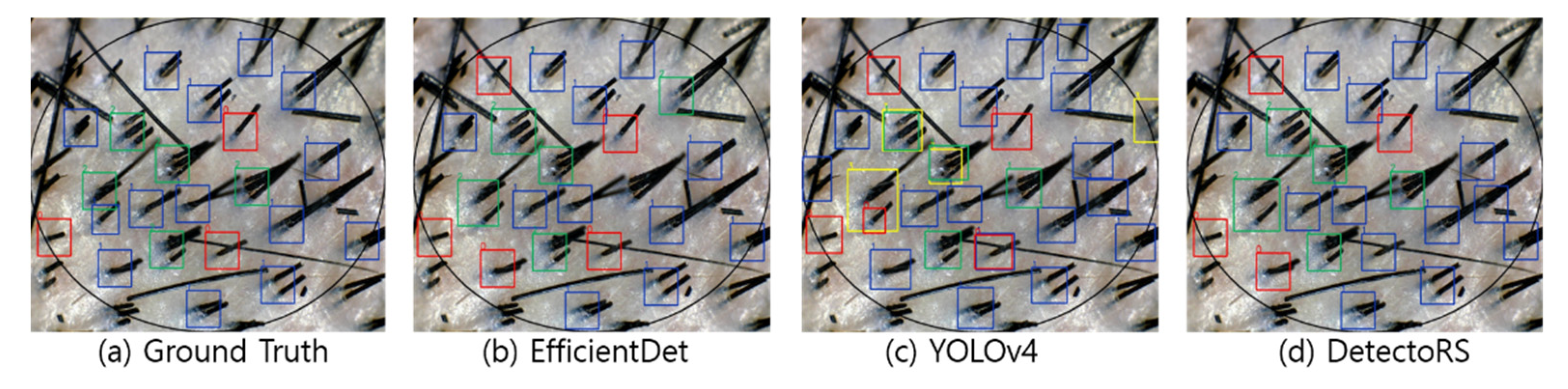 Sensors 22 00650 g007 550