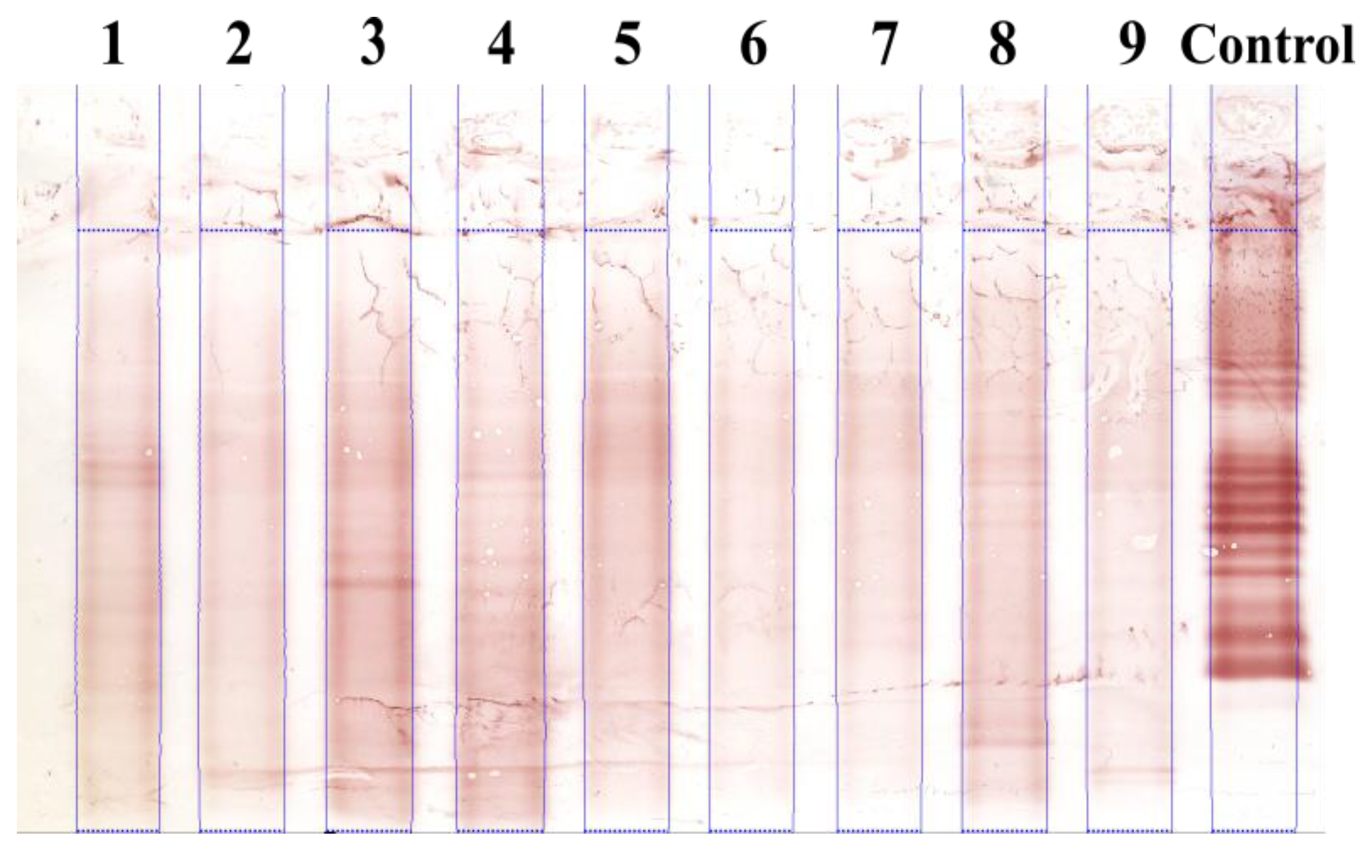 Sensors 22 00724 g007 550
