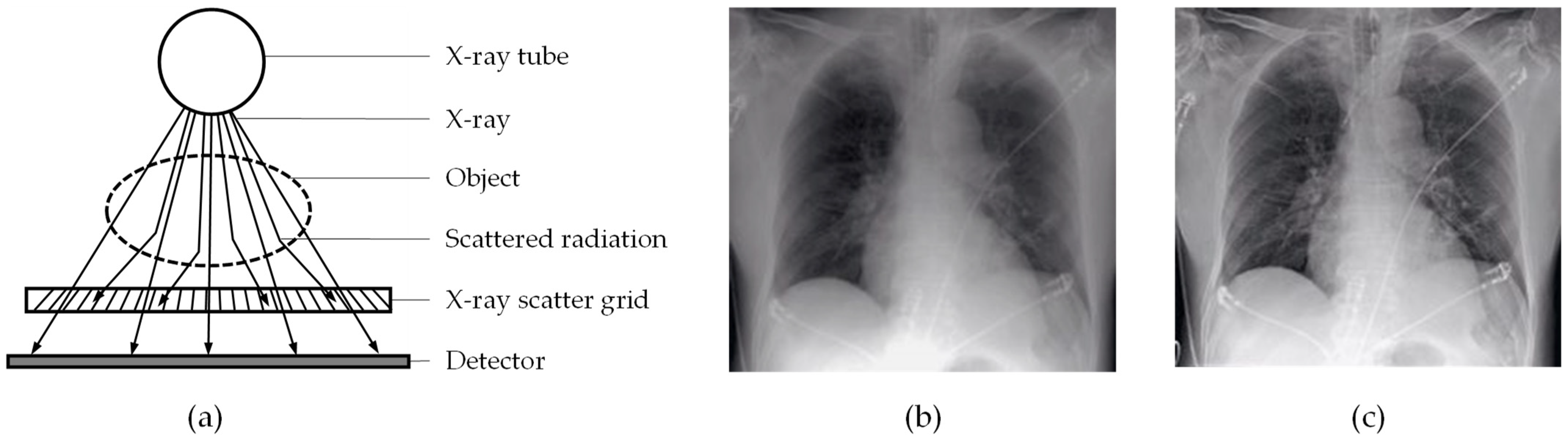 Sensors 22 00811 g001 550