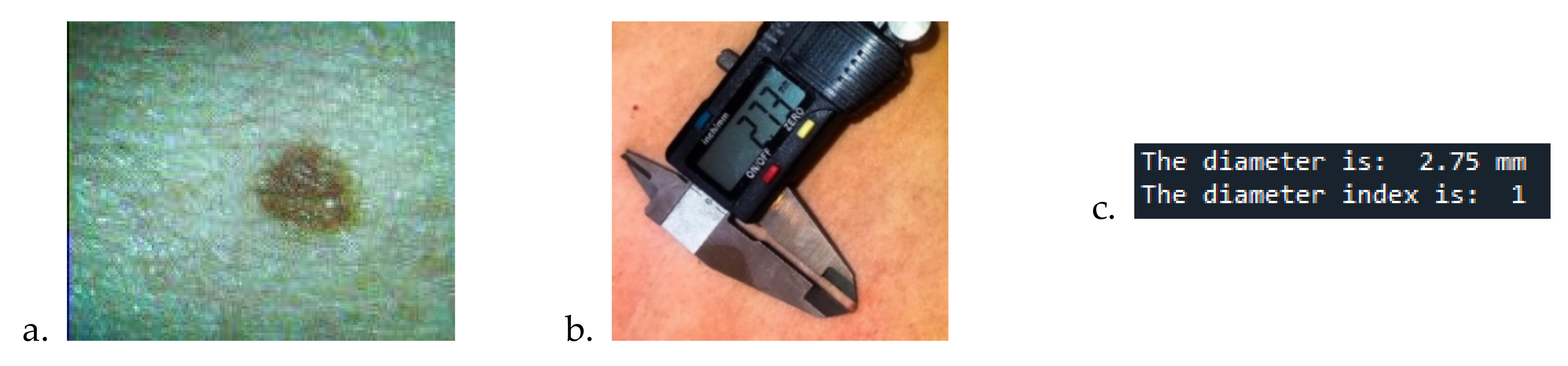 Sensors 22 01123 g008 550