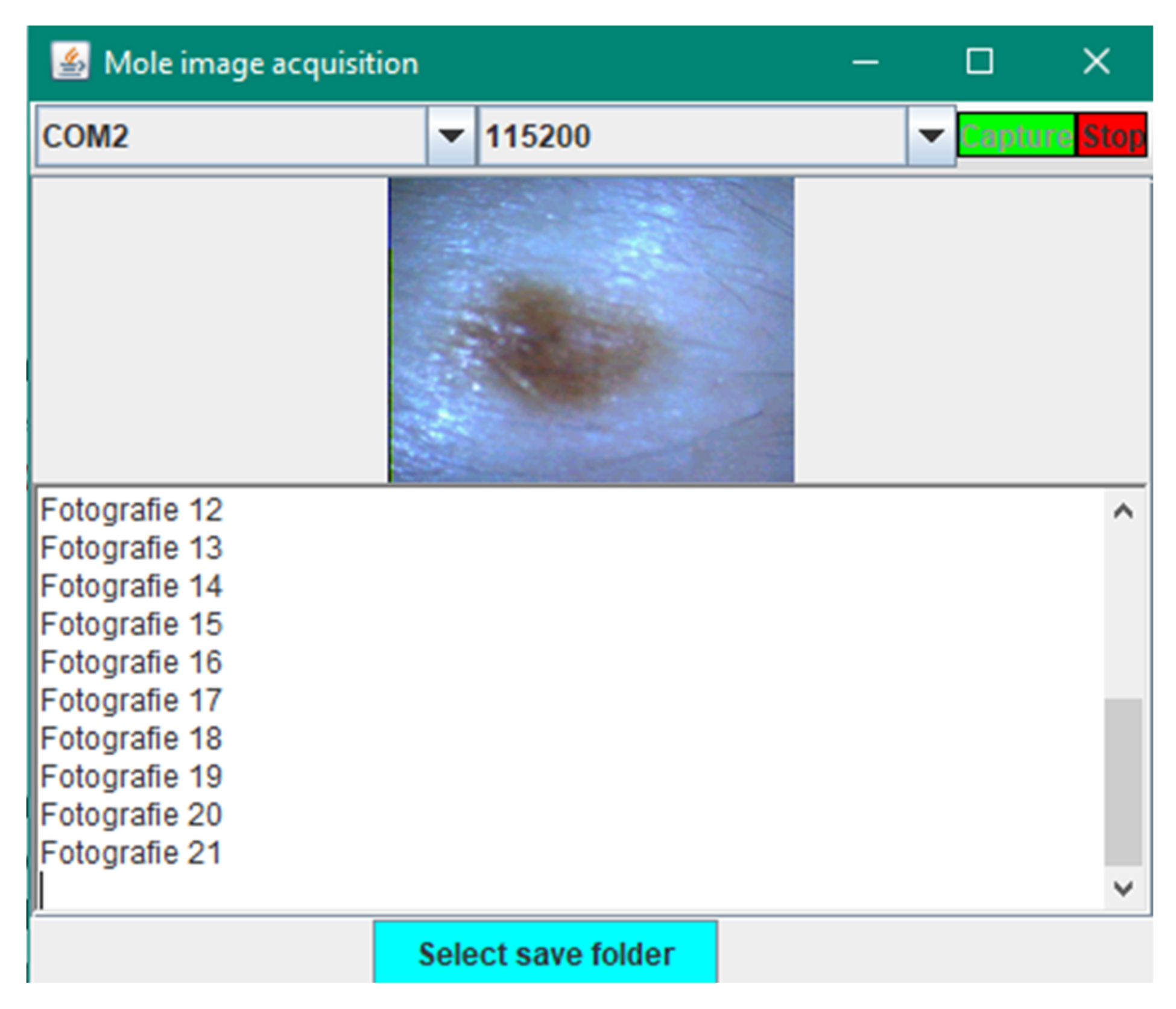 Sensors 22 01123 g009 550