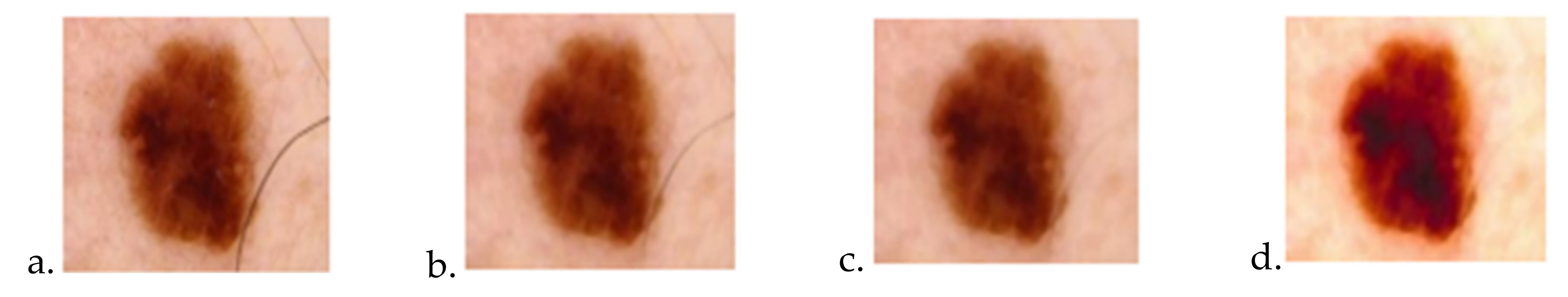 Sensors 22 01123 g010 550