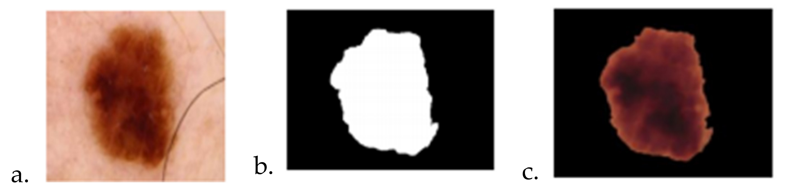 Sensors 22 01123 g011 550