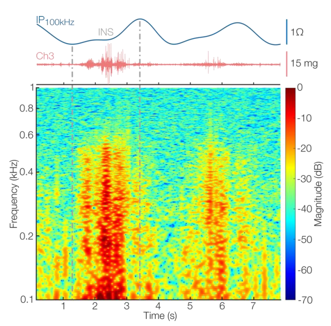 Sensors 22 01130 g007 550