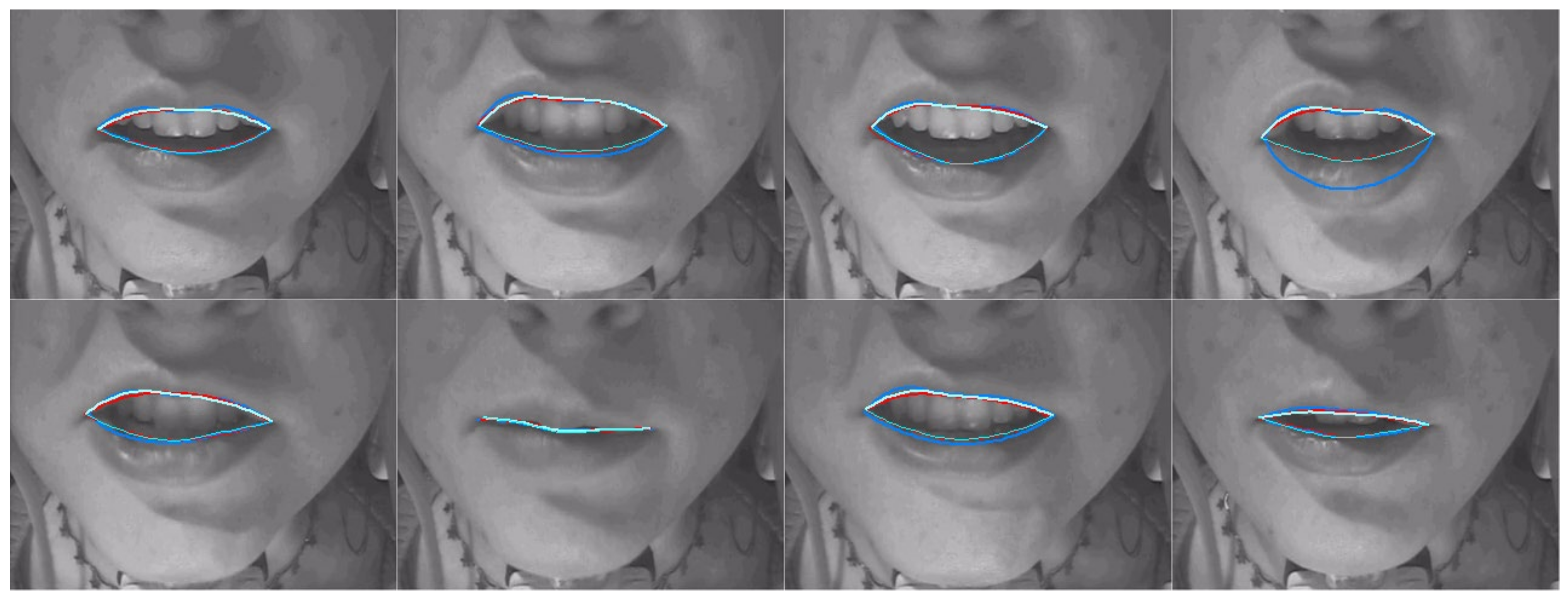 Sensors 22 01133 g016 550