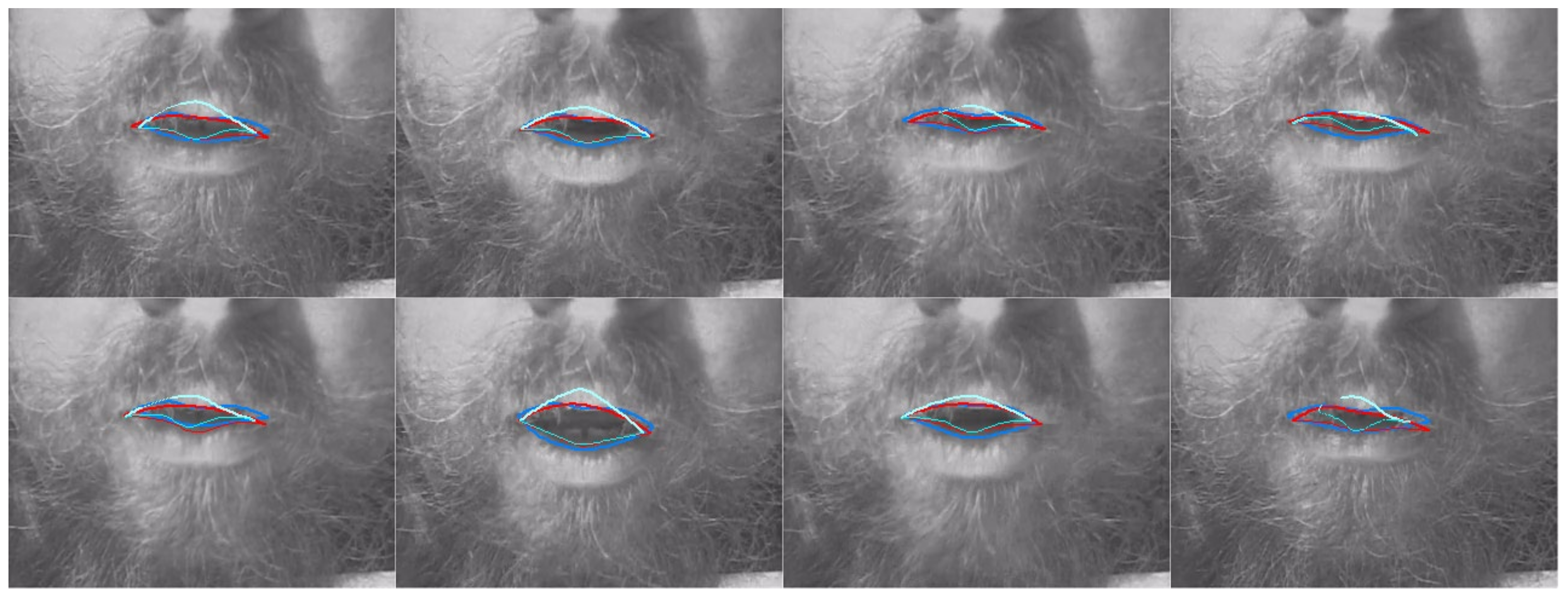 Sensors 22 01133 g018 550