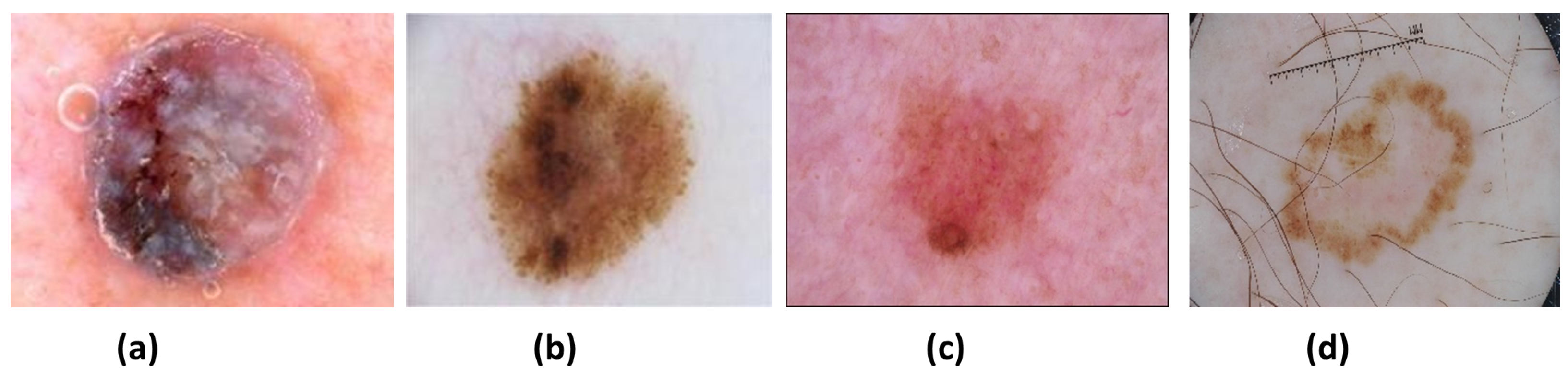 Sensors 22 01134 g001 550