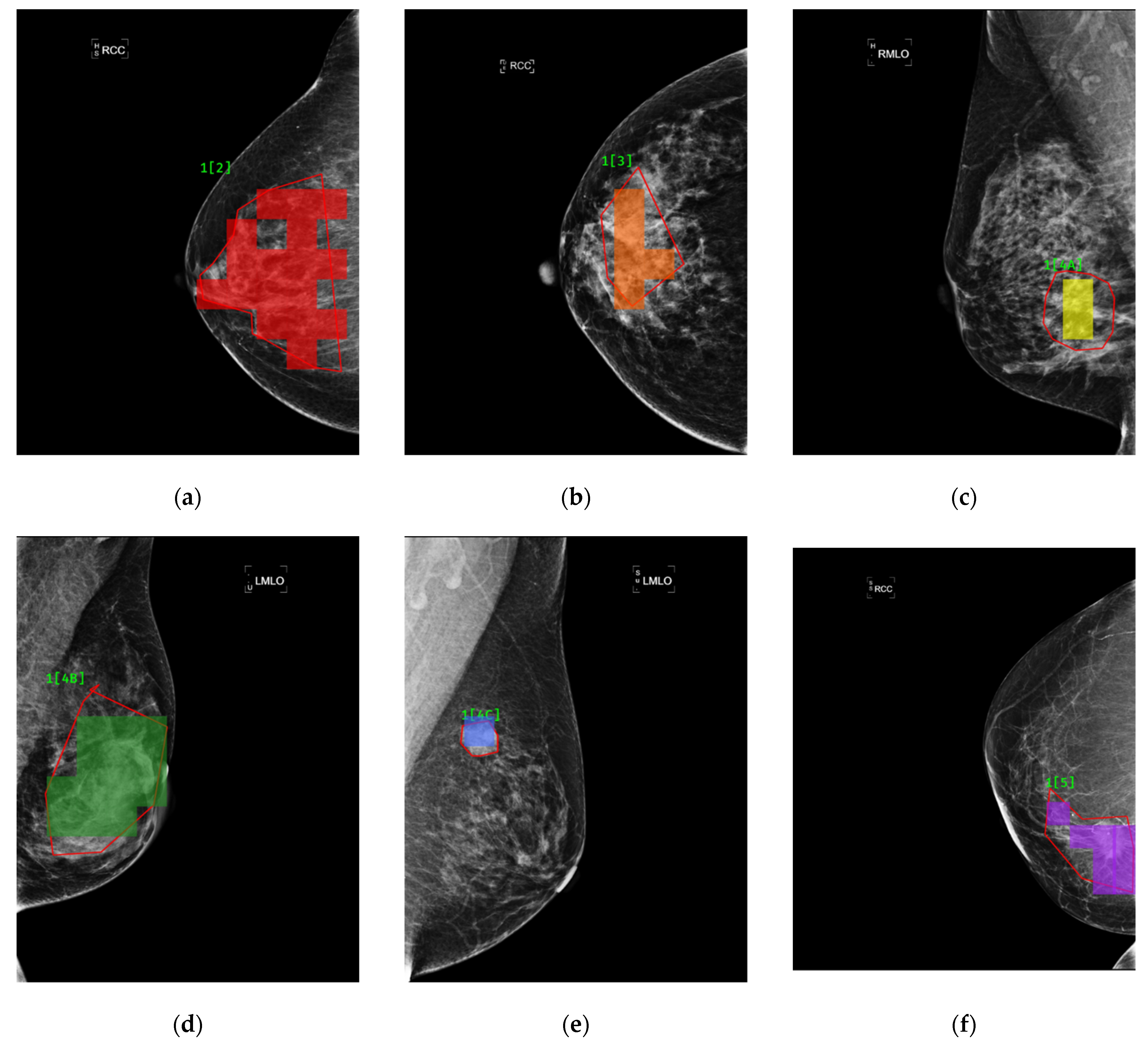 Sensors 22 01160 g011 550