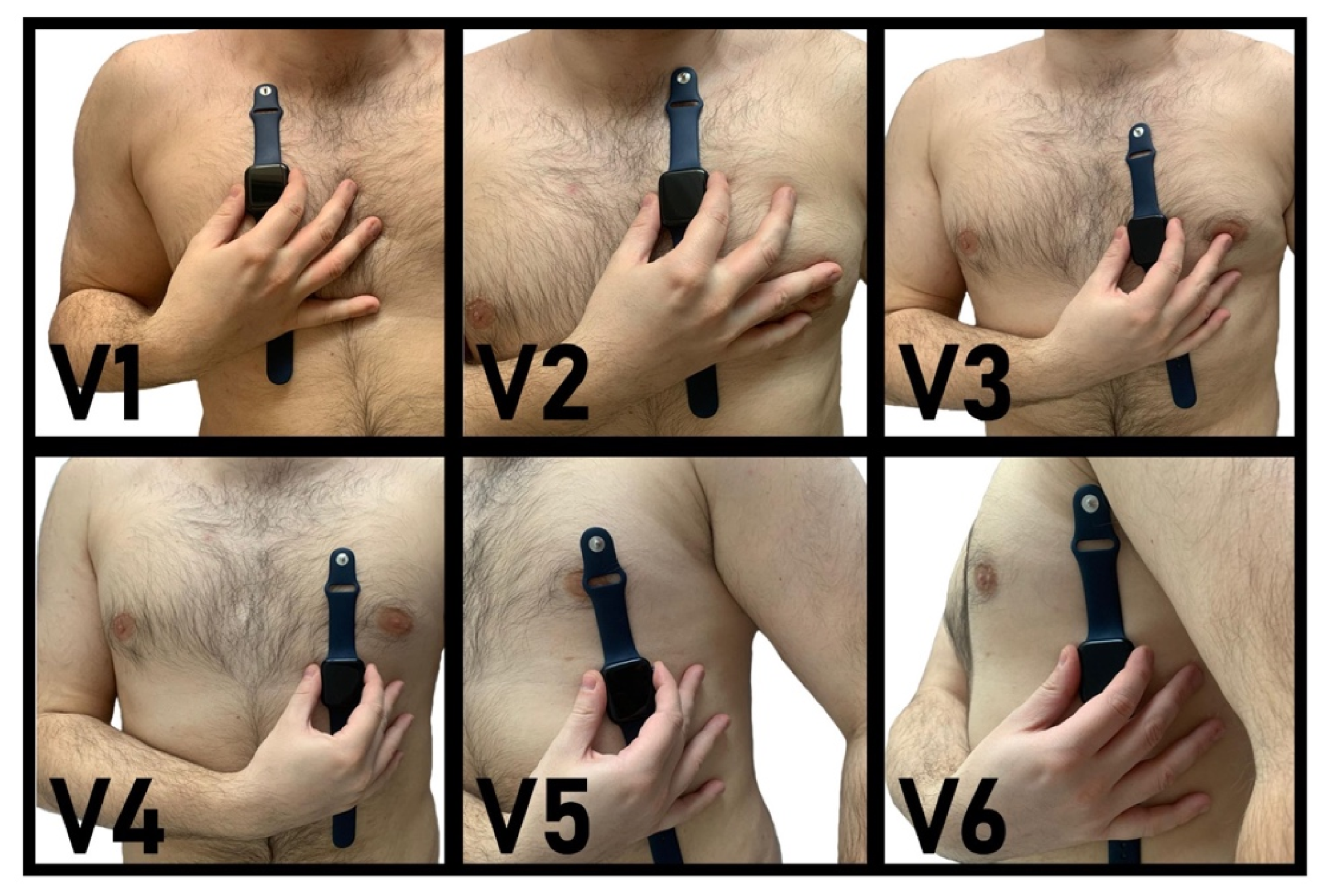 Sensors 22 01217 g001 550