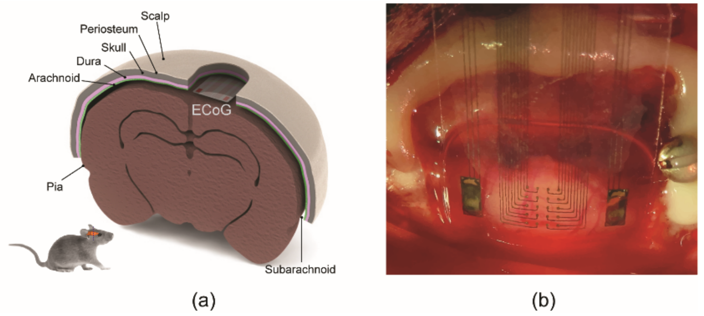 Sensors 22 01277 g007