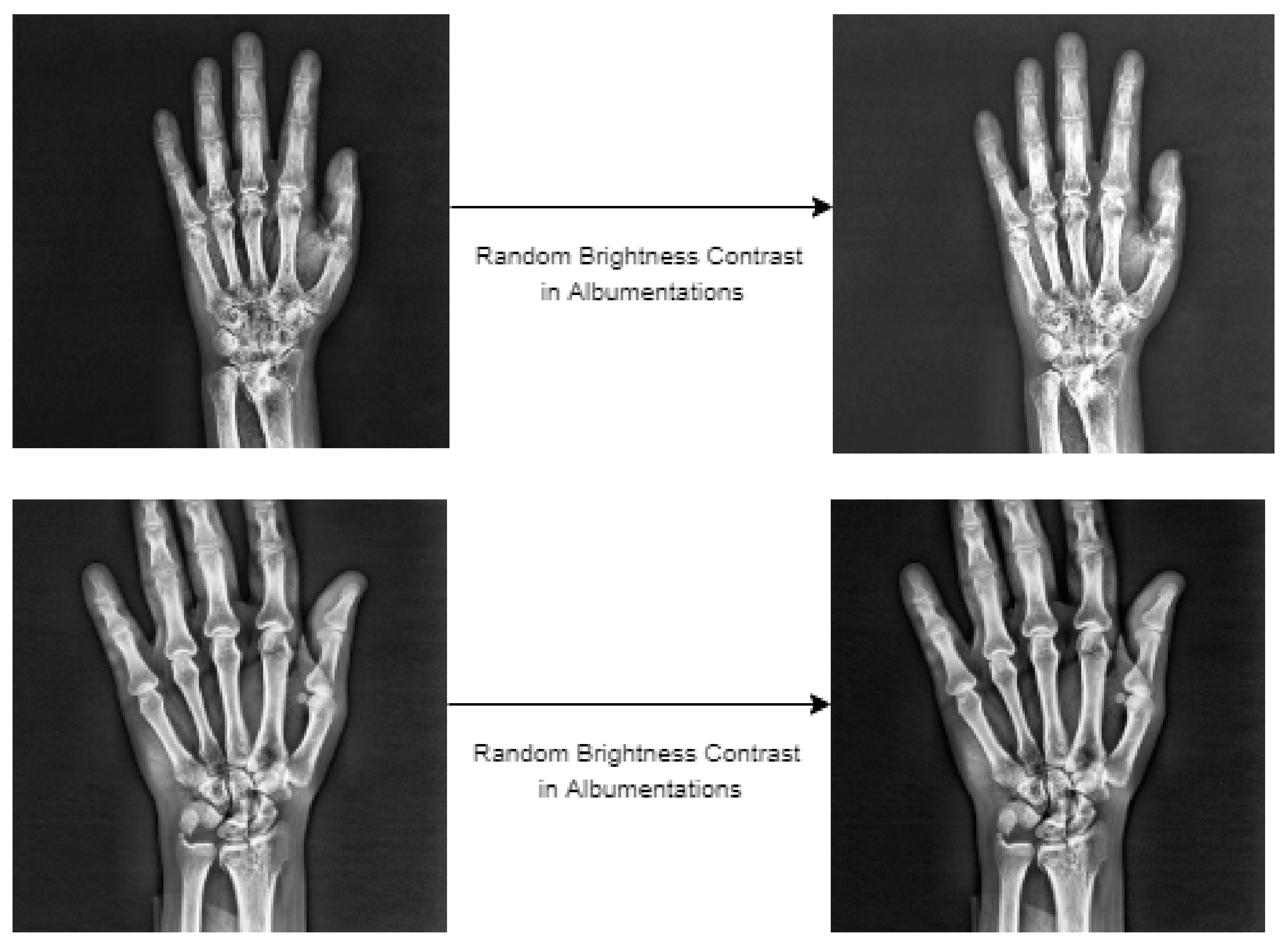 Sensors 22 01285 g012 550