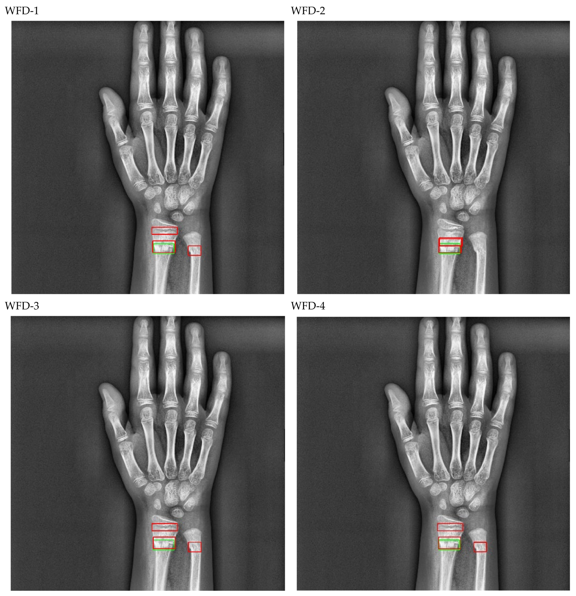 Sensors 22 01285 g020a 550