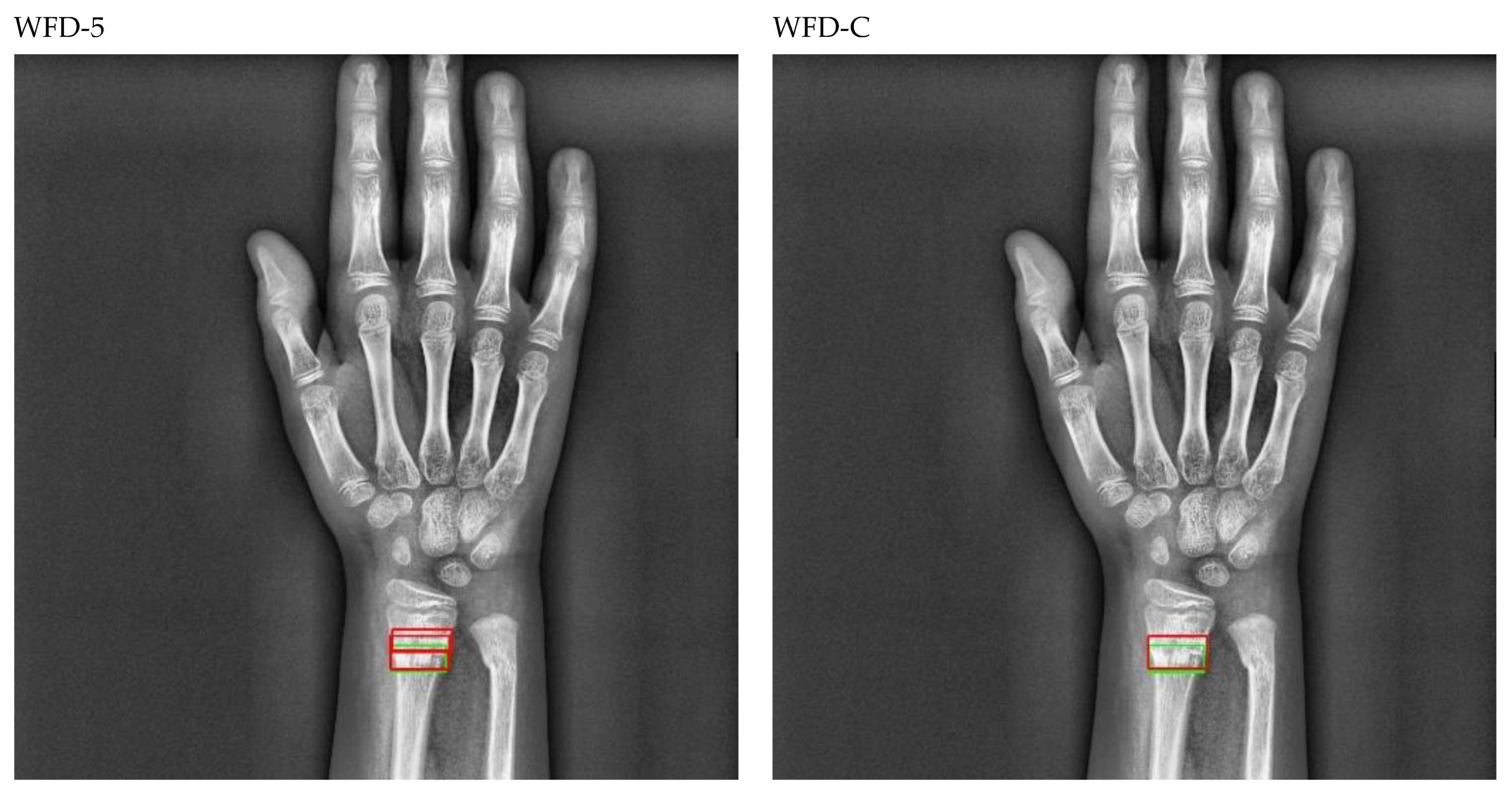 Sensors 22 01285 g020b 550