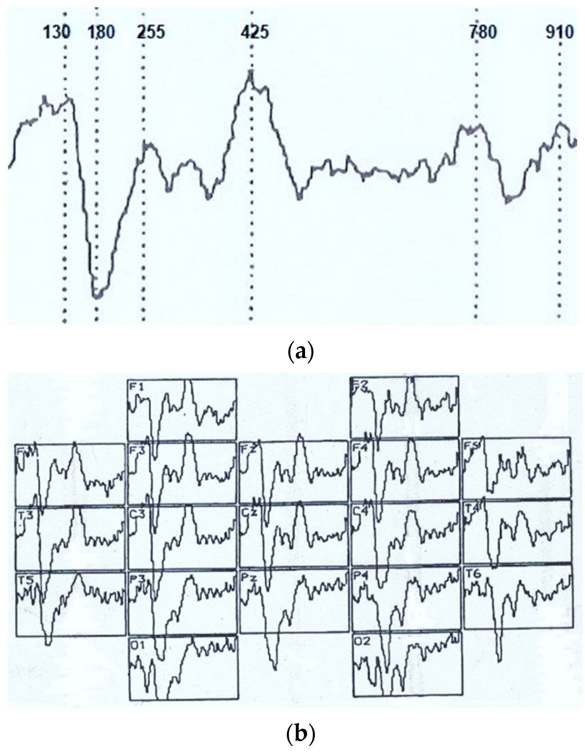 Sensors 22 01323 g001 550