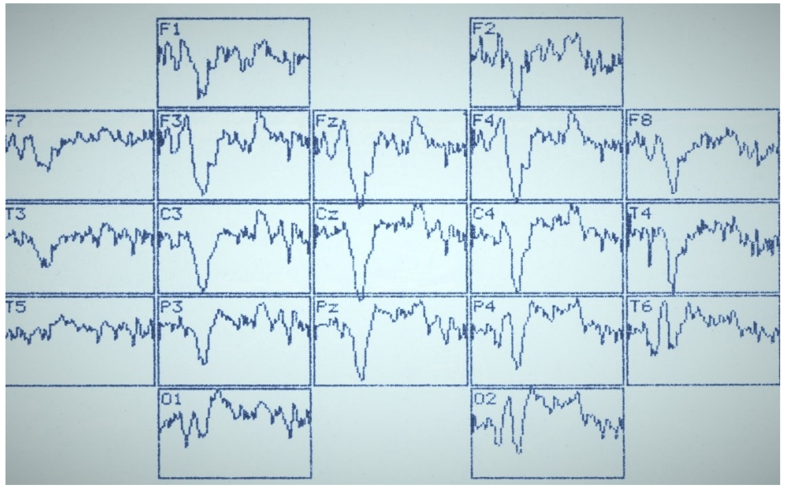 Sensors 22 01323 g003 550