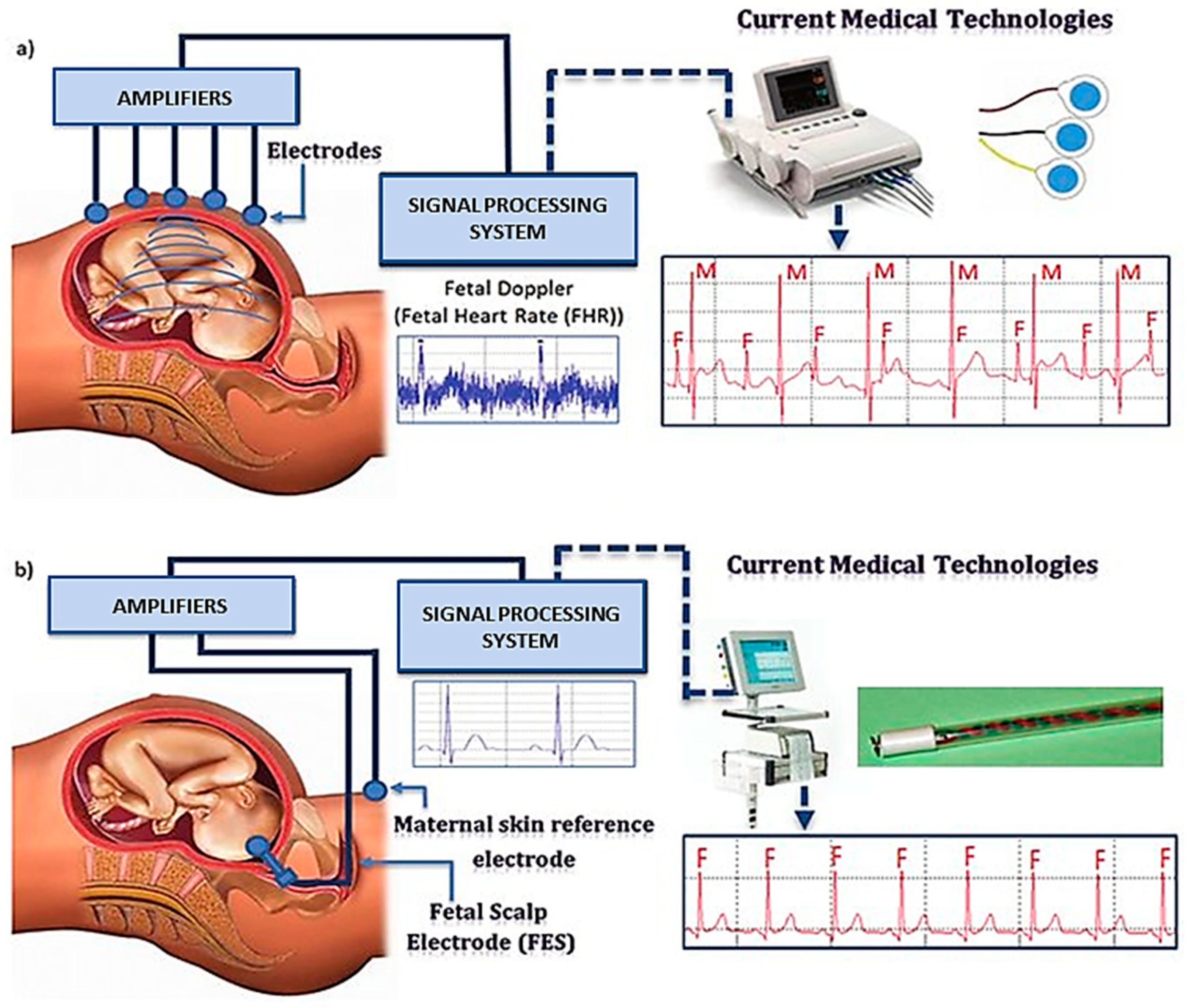 Sensors 22 01334 g002