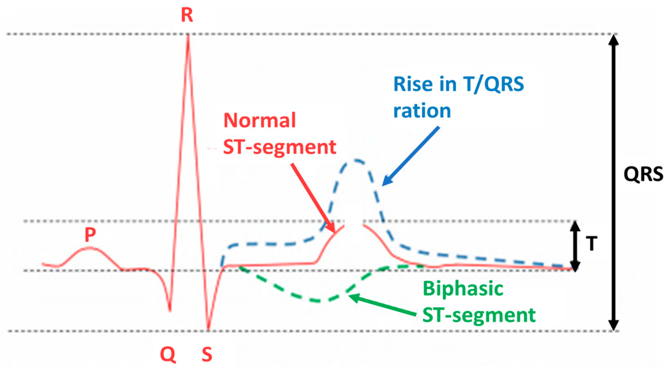 Sensors 22 01334 g003