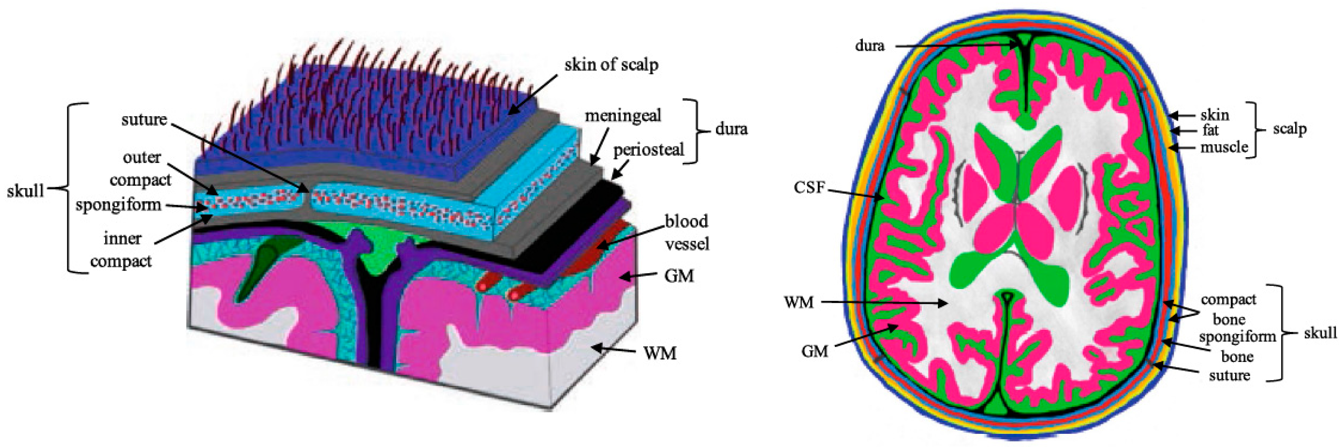 Sensors 22 01334 g011