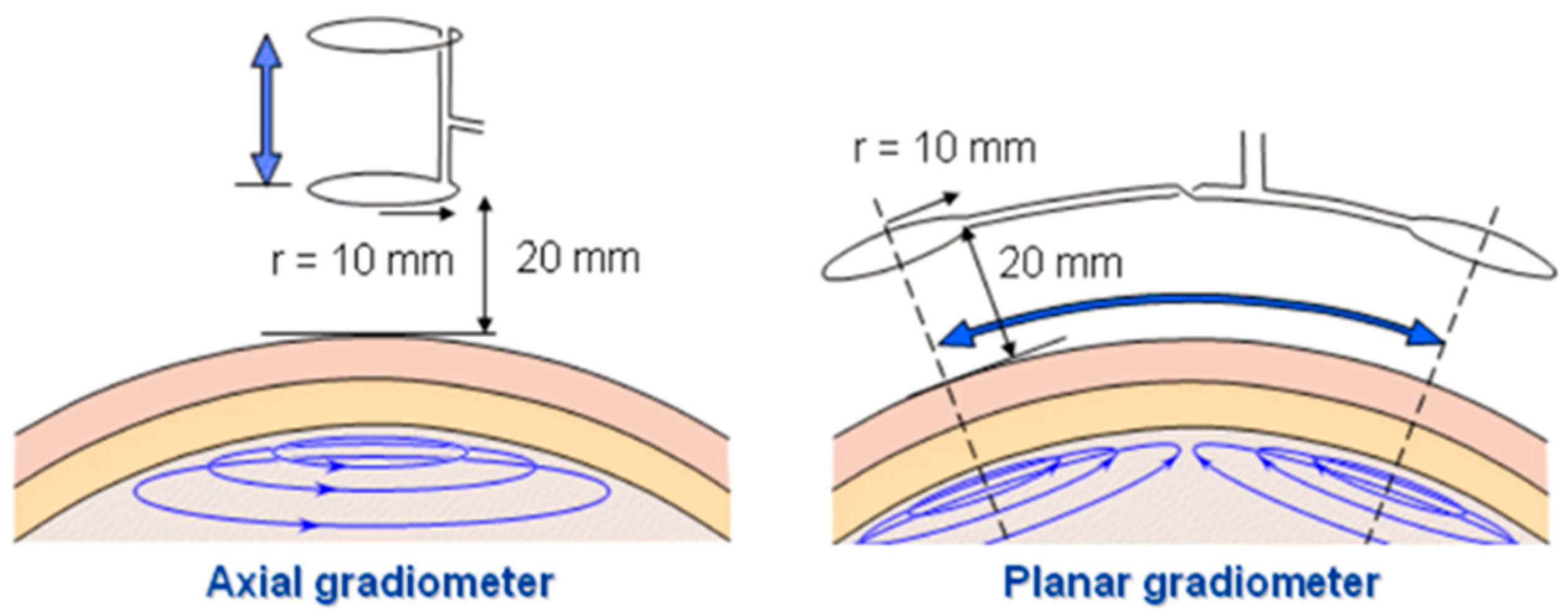 Sensors 22 01334 g017