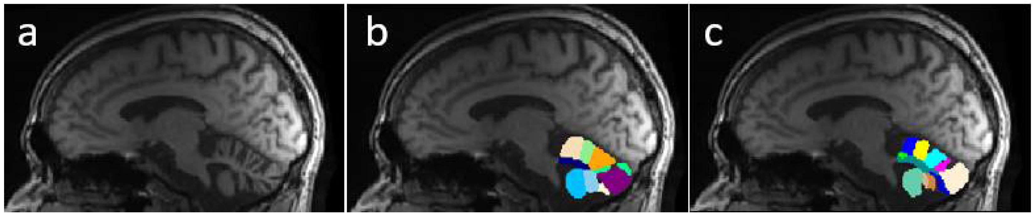 Sensors 22 01345 g001 550