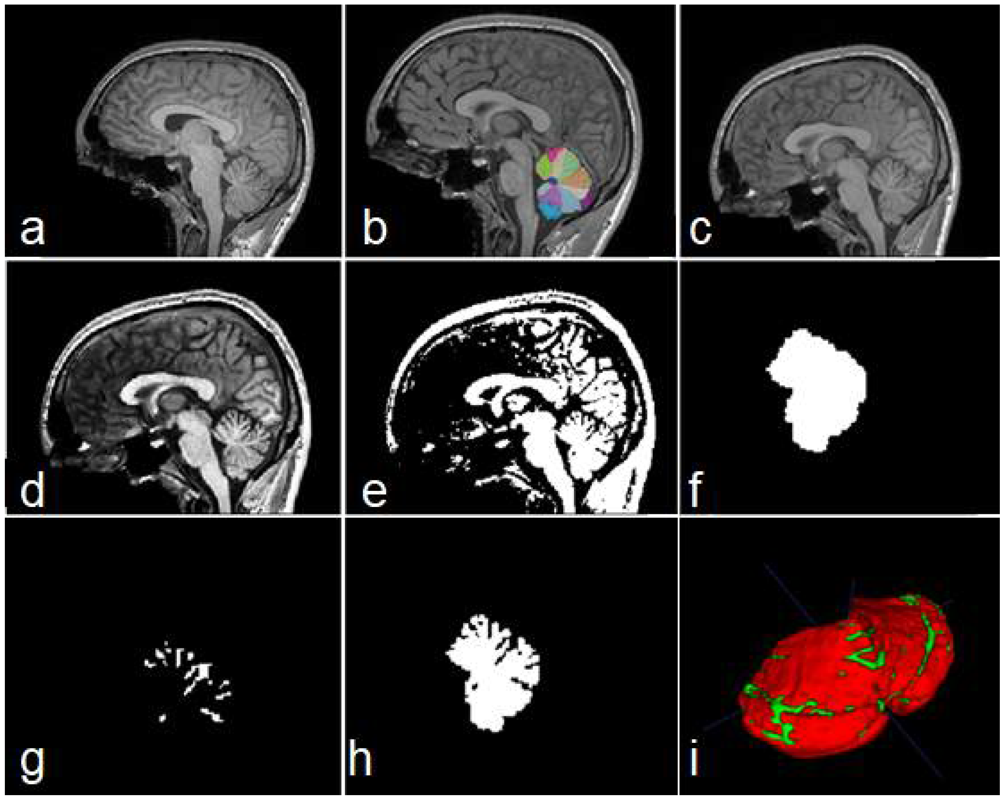 Sensors 22 01345 g003 550
