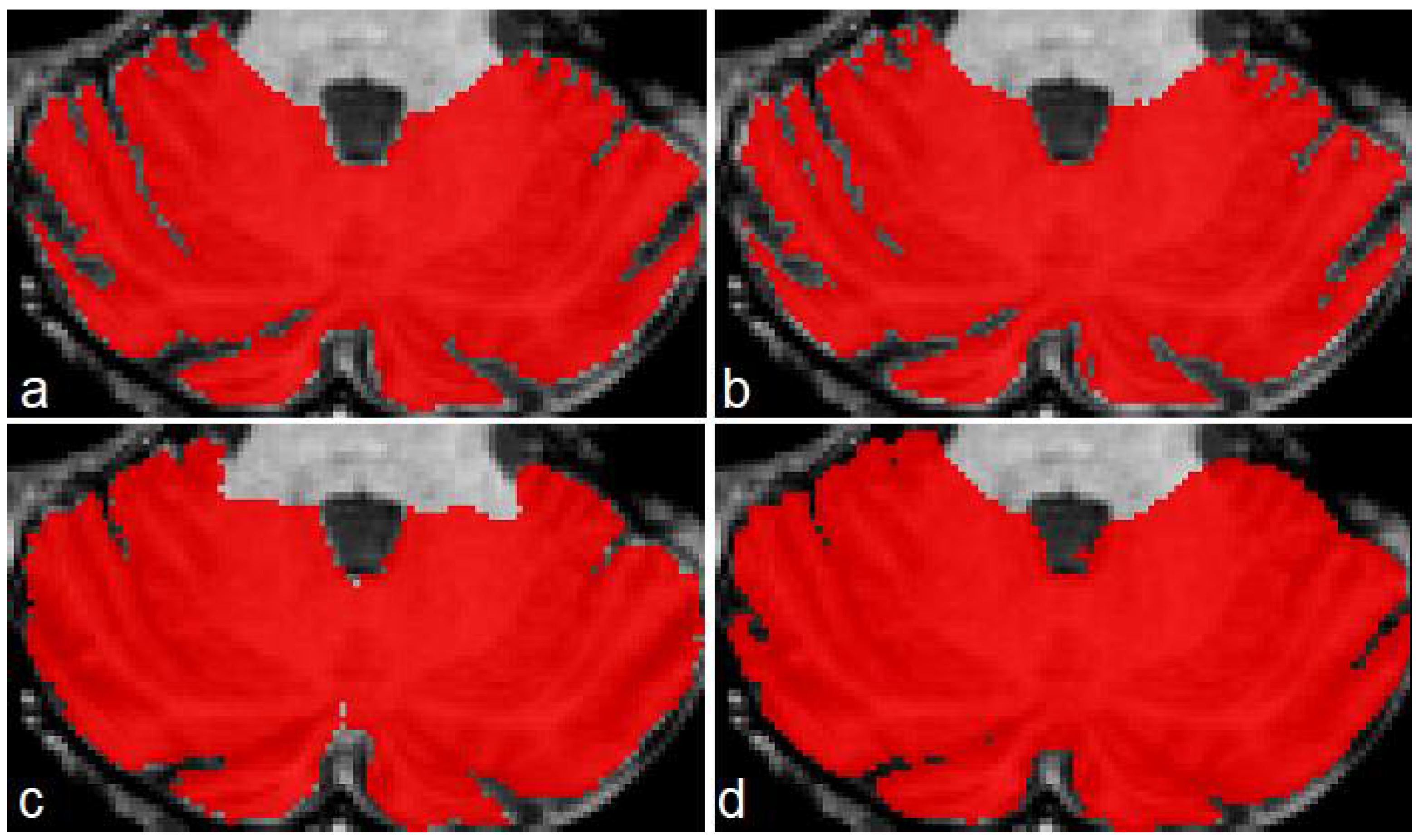 Sensors 22 01345 g006 550