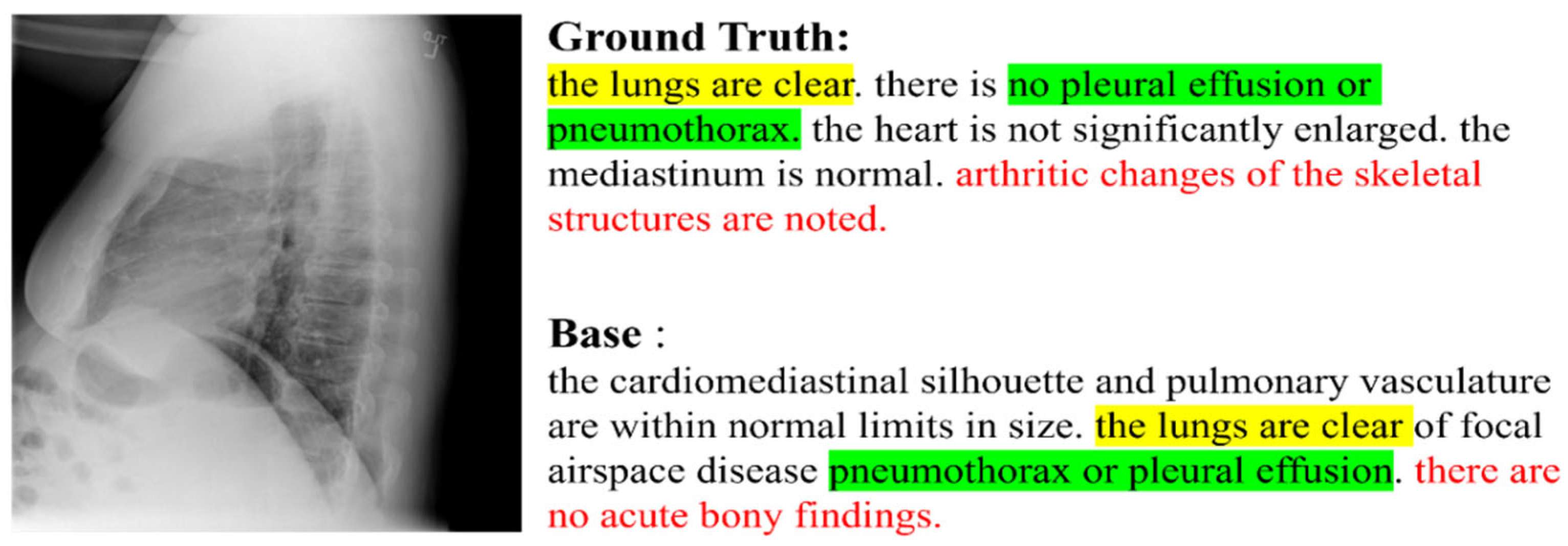 Sensors 22 01429 g001 550