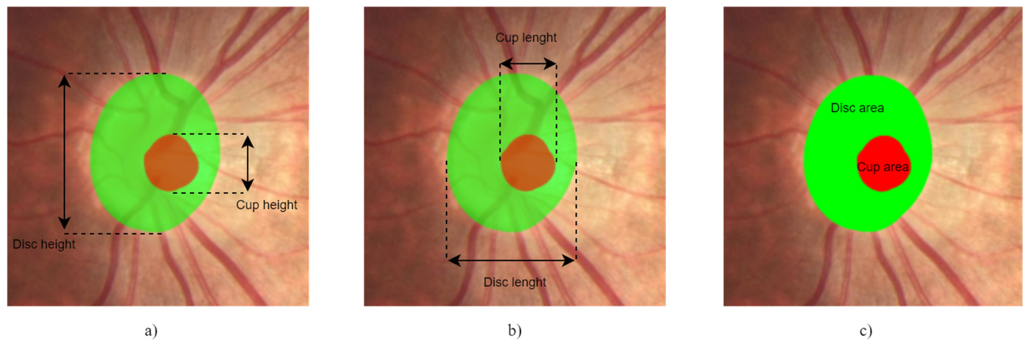 Sensors 22 01449 g003 550