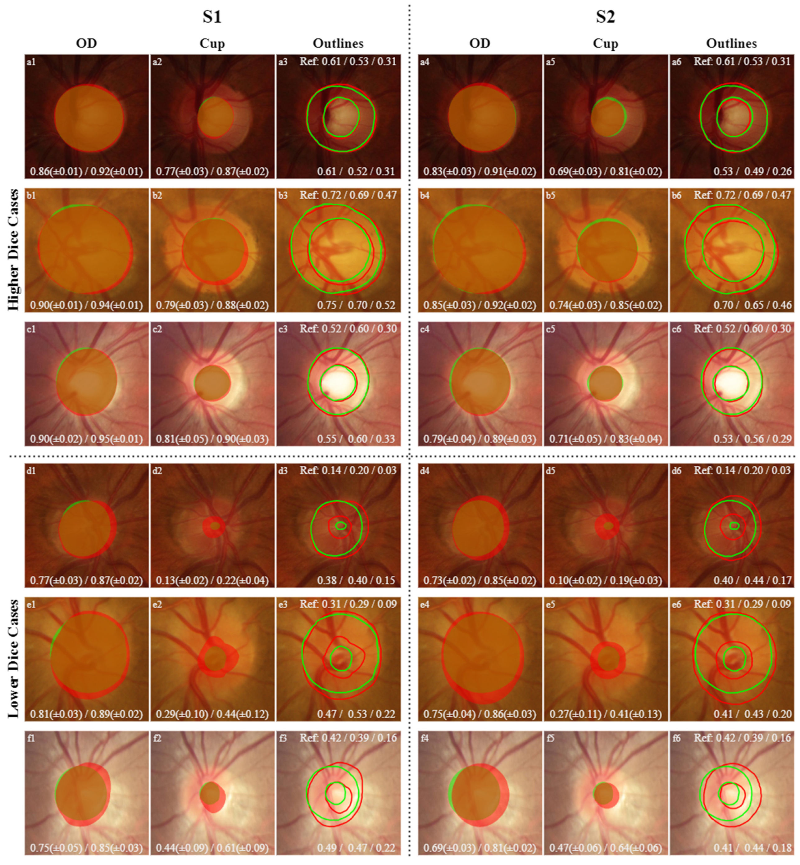 Sensors 22 01449 g009 550