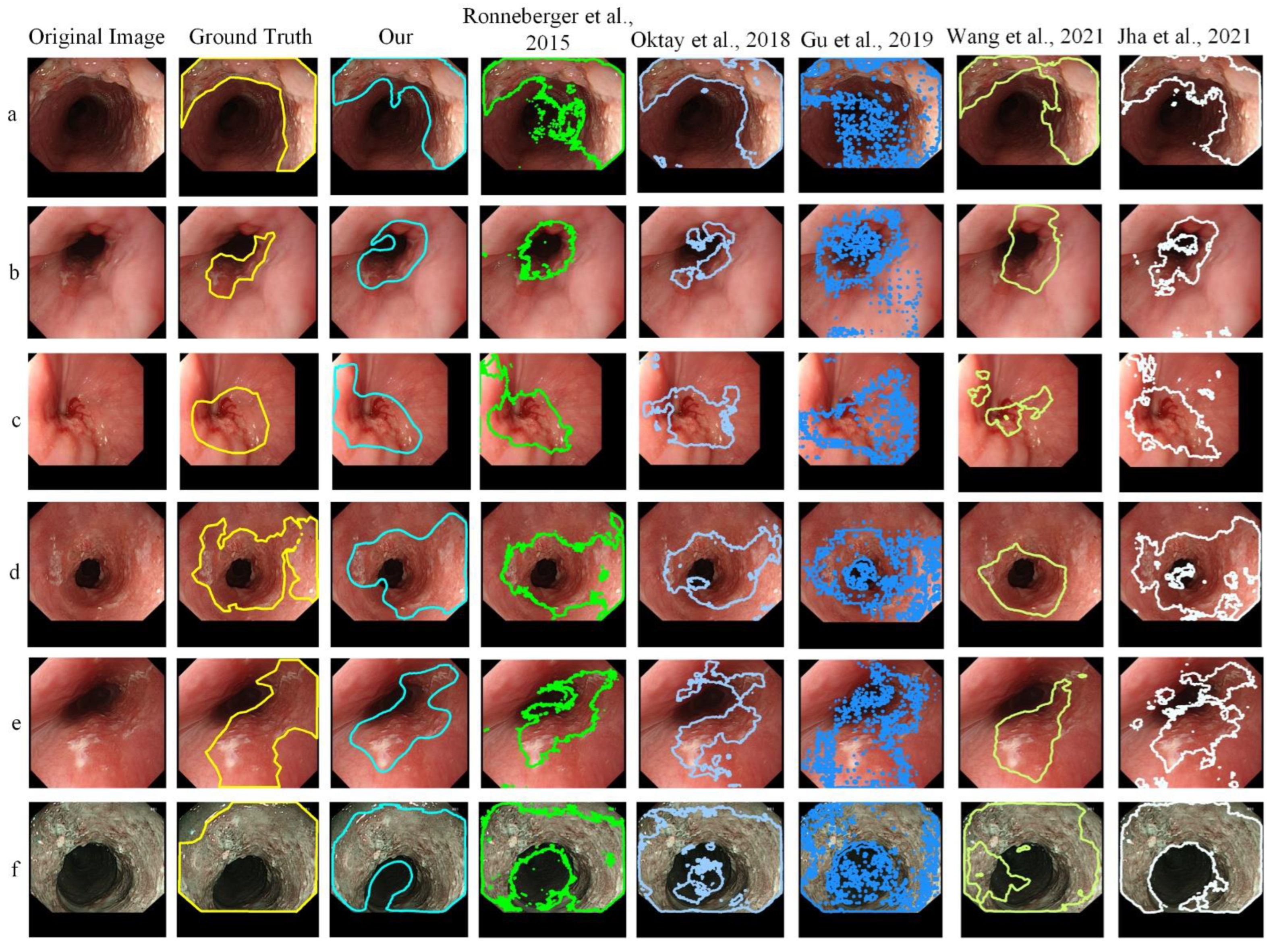 Sensors 22 01492 g006 550