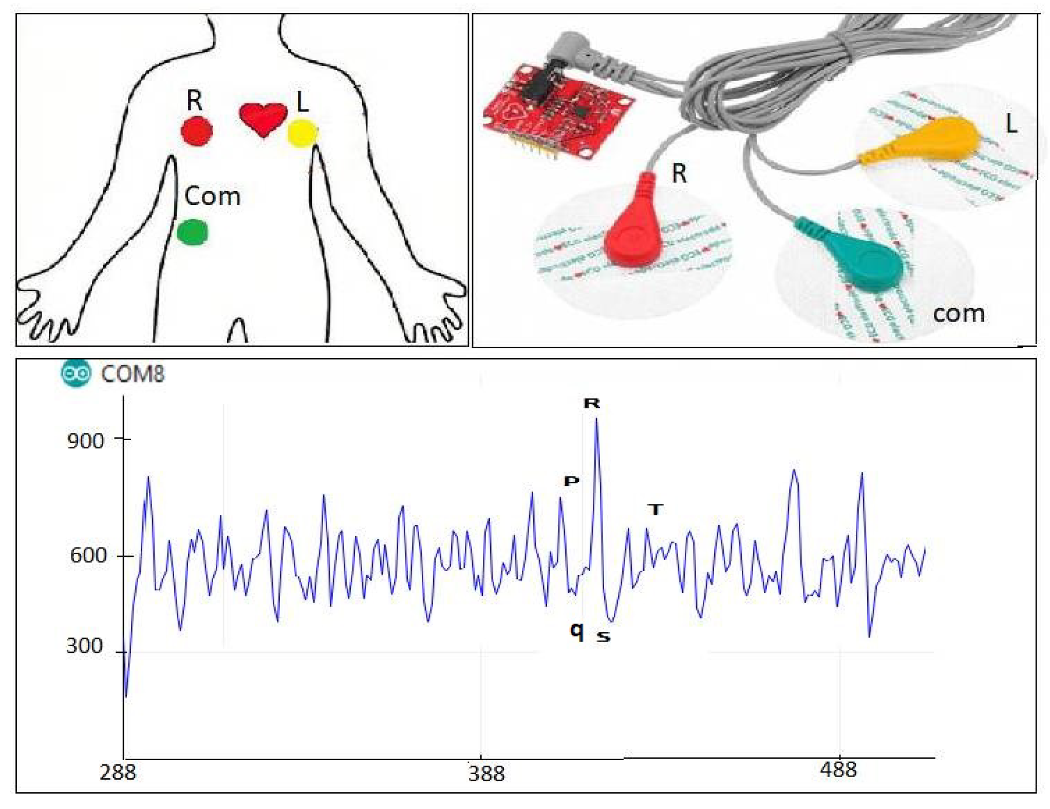 Sensors 22 01497 g004 550