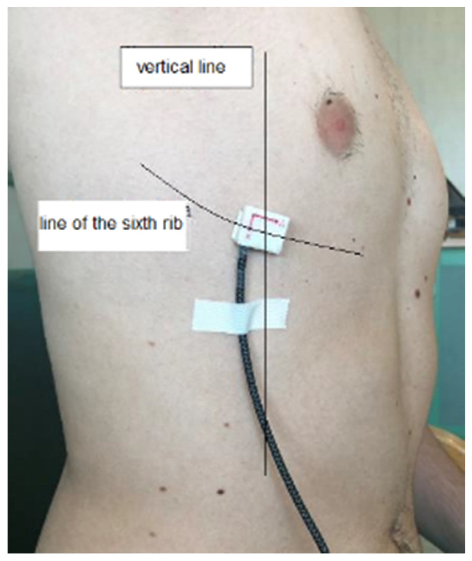 Sensors 22 01561 g005 550